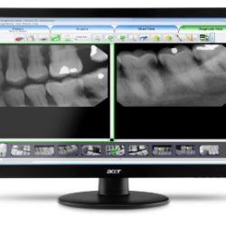 dental imaging software, dental software
