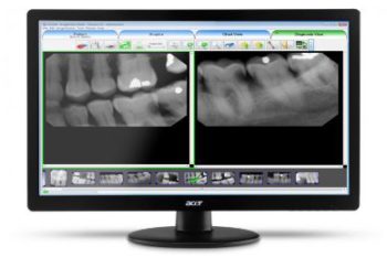 dental imaging software, dental software